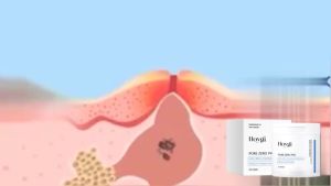 Hoygi Pad Toner Asam Salisilat Pembersihan Lembut Eksfoliasi Melembapkan Menutrisi Kompres Basah Perawatan Wajah
