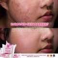 ORIGINAL  BMRS Niacinamide with Glutathione Premium Whitening Soap with 10x Whitening and Moisturizing/Anti- acne marks. 