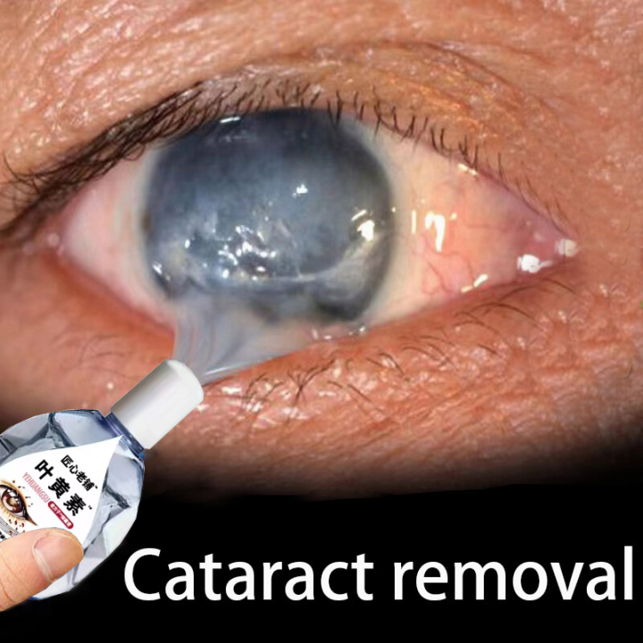 Eye Drops for dry eye Cataract eye drops Eye Wash Care Eye Washer Eye