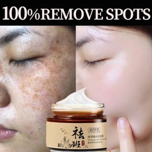 Melasma serum remover Melasma and pekas remover serum original Whitening Dark Spot Remover serum  for face to remove effective freckles remover Brightening Skin Care Fade Freckle
