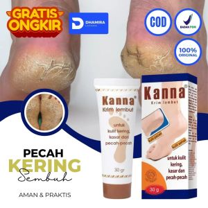 Salep Kaki Pecah2 Dan Kering - Kanna Salep Krim Obat Masker Kaki Pecah2 Dan Kering Parah Yg Ampuh Pembersih Penghalus Tumit Pecah Mengelupas