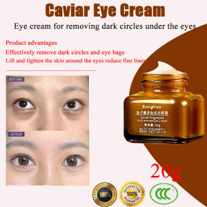 7-day effective removal of eye bags Eye cream anti edema gel black eye circles anti-aging wrinkles firming skin brightening mild and non irritating 眼袋眼霜