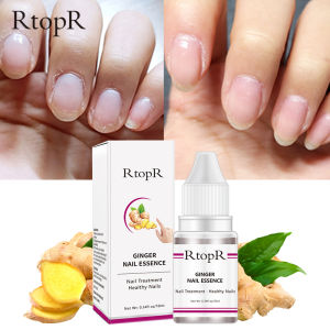 RtopR 3 ชิ้น FDA ยาทาเล็บ ขิง เซรั่มรักษาเล็บ เซรั่มซ่อมเซมเล็บ GINGER NAIL ESSENCE