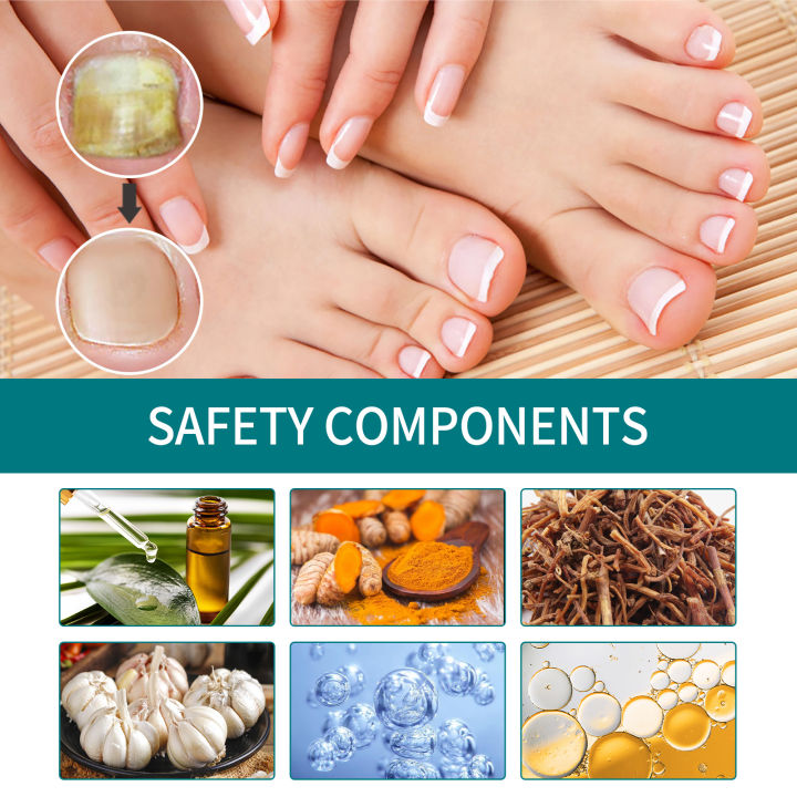 %E3%80%90100%25%20Effective%E3%80%91Jaysuing%20Fungal%20Nail%20Treatment%20Patch%20Anti%20Infection%20Paronychia%20Thickening%20Soft%20Waterproof%2032pcs%20-%20Image%207