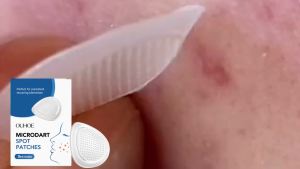 OUHOE Acne Treatment Patch Gentle formula for skin care skin-friendly breathable nourishing portable acne patch