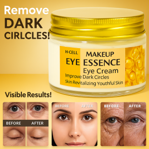 Eye Essence Revitalizing Youthful Skin Eye Care Improve Dark Circles Niacinamide Beauty Skin Care