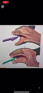 Animal Special Gas Blinker Cat and Rabbit Tracheal intubation Blind intubation