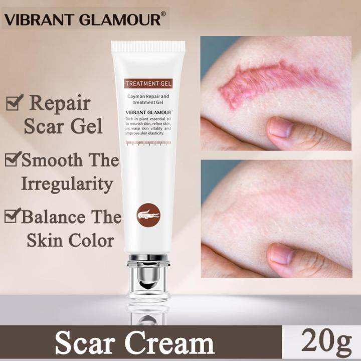 Scar Cream, Acne Scar Removal Cream, Skin Repair Scars Burns Cuts ...