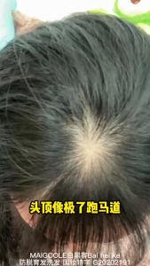 Hair Growth Shampoo hair loss shampoo 400ml anti-hair loss promote hair growth  strengthen hair roots hair growth 防脱育发