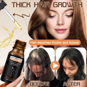 Original Ginger Hair Growth Serum 7X Rapid Growth Hair Treatment Hair Grower