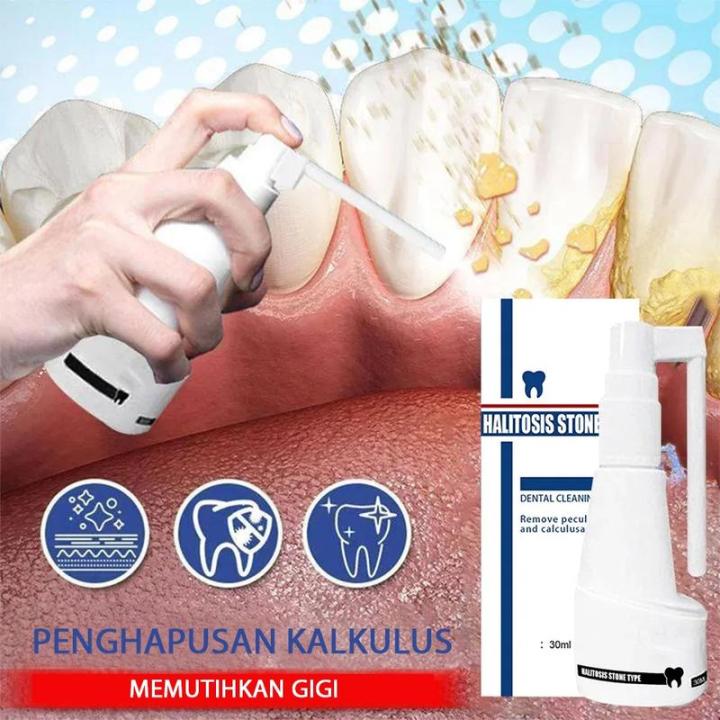 Calculus Control Toothpaste Dental Calculus Dissolving Oral Spray 30ml Tartar Cleaning Spray ...