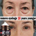 Cream Mata Panda Aging Eye Cream Remove Dark Circles Repair Puffiness/krim menghilang kan kantung mata- Krim Pemutih Kantung Mata - krim mata pencerah - cream untuk mata panda - Cream mata panda dan keriput - penghilang kantung mata kendur. 