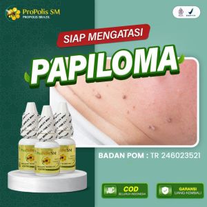 Obat Papiloma Daging Tumbuh Keloid Daging Jadi Bekas Operasi Caesar bekas luka Propolis SM