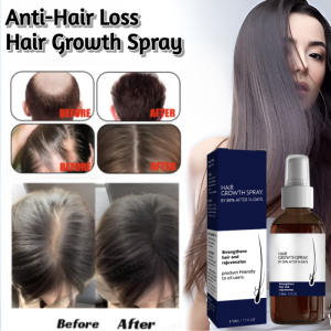 Hair Growth Spray Natural Anti-Hair Loss Product Quickly Nourishes Hair Roots Growth Treatment Hair Growth Liquid Suitable For Men And Women