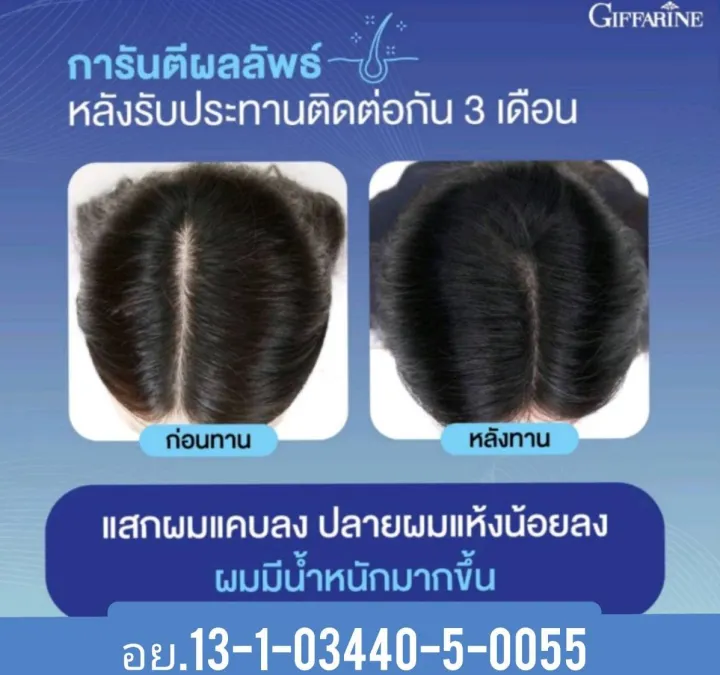 %E0%B9%84%E0%B8%9A%E0%B9%82%E0%B8%AD%E0%B8%95%E0%B8%B4%E0%B8%99%20%E0%B9%80%E0%B8%AD%E0%B8%8A%20%E0%B8%9E%E0%B8%A5%E0%B8%B1%E0%B8%AA%20%E0%B8%81%E0%B8%B4%E0%B8%9F%E0%B8%9F%E0%B8%B2%E0%B8%A3%E0%B8%B5%E0%B8%99%20Biotin%20H%20Plus%20%20%E0%B9%84%E0%B8%9A%E0%B9%82%E0%B8%AD%E0%B8%95%E0%B8%B4%E0%B8%99%20%E0%B9%80%E0%B8%AD%E0%B8%8A%20%E0%B8%9E%E0%B8%A5%E0%B8%B1%E0%B8%AA%20%E0%B9%84%E0%B8%A1%E0%B9%88%E0%B8%AD%E0%B8%A2%E0%B8%B2%E0%B8%81%E0%B9%80%E0%B8%AA%E0%B8%B5%E0%B8%A2%E0%B9%83%E0%B8%88%20%E0%B8%AD%E0%B8%A2%E0%B9%88%E0%B8%B2%E0%B8%9B%E0%B8%A5%E0%B9%88%E0%B8%AD%E0%B8%A2%E0%B9%83%E0%B8%AB%E0%B9%89%E0%B8%8A%E0%B8%B5%E0%B8%A7%E0%B8%B4%E0%B8%95%E0%B8%82%E0%B8%B2%E0%B8%94..%E0%B8%9C%E0%B8%A1%20%20%E0%B8%97%E0%B8%A7%E0%B8%87%E0%B8%84%E0%B8%B7%E0%B8%99%E0%B8%9C%E0%B8%A1%E0%B9%81%E0%B8%82%E0%B9%87%E0%B8%87%E0%B9%81%E0%B8%A3%E0%B8%87%E0%B8%AA%E0%B8%B8%E0%B8%82%E0%B8%A0%E0%B8%B2%E0%B8%9E%E0%B8%94%E0%B8%B5%20-%20Image%205