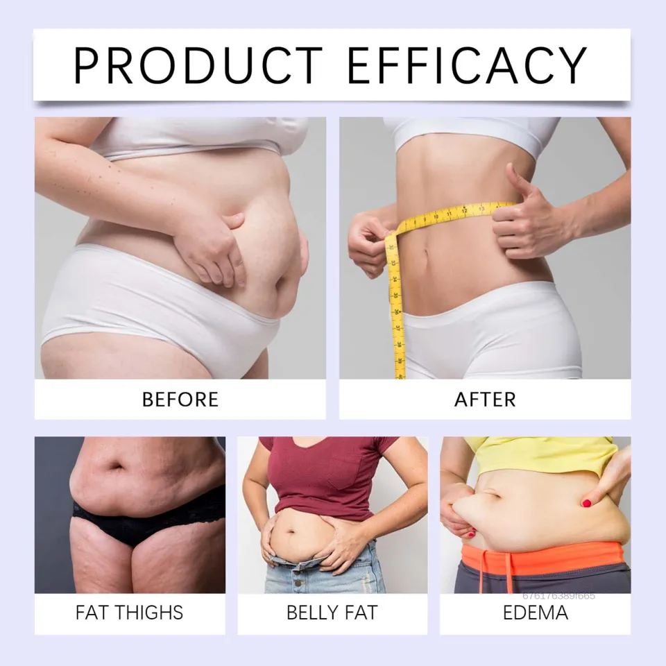 how common are glp 1 side effects Managing Side Effects of GLP-1 Receptor Agonists – Transformation Weight  Control