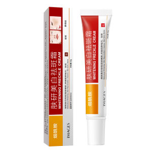 Anti Freckle Whitening Cream 30g Removing Age Dark Spots Pigmentation Bright Skin Care Day Sun Freckles Remover for Women 祛斑霜 消除黑色素沉着