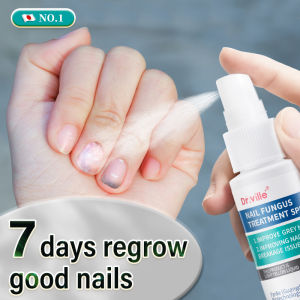 Japan Nail Fungus Treatment Nail Repair Spray Clear Discoloured Nails 100% Authentic Foot Hand Care Toenail Health Care Solution 灰指甲治疗液
