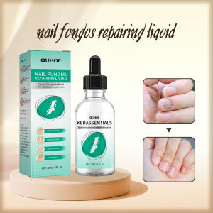 Ouhoe Nail Fungus Repair Liquid Repair Anti Infection Onychomycosis Treatment Foot Toe Nails Craked Nail Bacteria Cuticle Improve Moisturizing Strengthening Nail Care 30ml