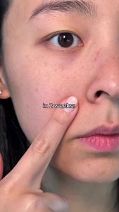 Torriden CELLMAZING Pore ing Ampoule 30ml (1.01 fl.oz.) Cải thiện độ đàn hồi của da Collagen 5D phức hợp Peptide PHA LHA Serum dưỡng da mặt Hàn Quốc Chăm sóc da Hàn Quốc