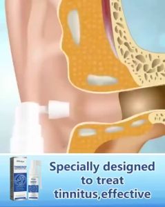 READY STOCK Tinnitus Relief Spray Relieve Tinnitus Ear Pain Discomfort Ear Drops Hearing Protection Gentle Care COD