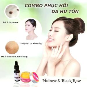 Combo Serum black rose và kem mulros