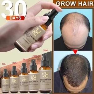 10/15/20/30ml New Hair Growth Spray Fast Grow Hair Hair LossTreatment Preventing Hair Loss Hair Care...