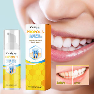Oralhoe Nước Súc Miệng Keo Ong Propolis 60ml - Dung dịch súc miệng chứa chiết xuất keo ong và tinh dầu bạc hà giúp hơi thở thơm mát hỗ trợ làm sạch khoang miệng dịu nhẹ không cồn dùng hàng ngày