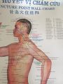 Tranh châm cứu huyệt vị. 
