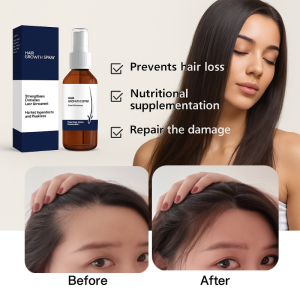Hair Growth Spray Nourish Scalp Promote Hair Growth Hair Care Anti-Hair Loss For Men And Women