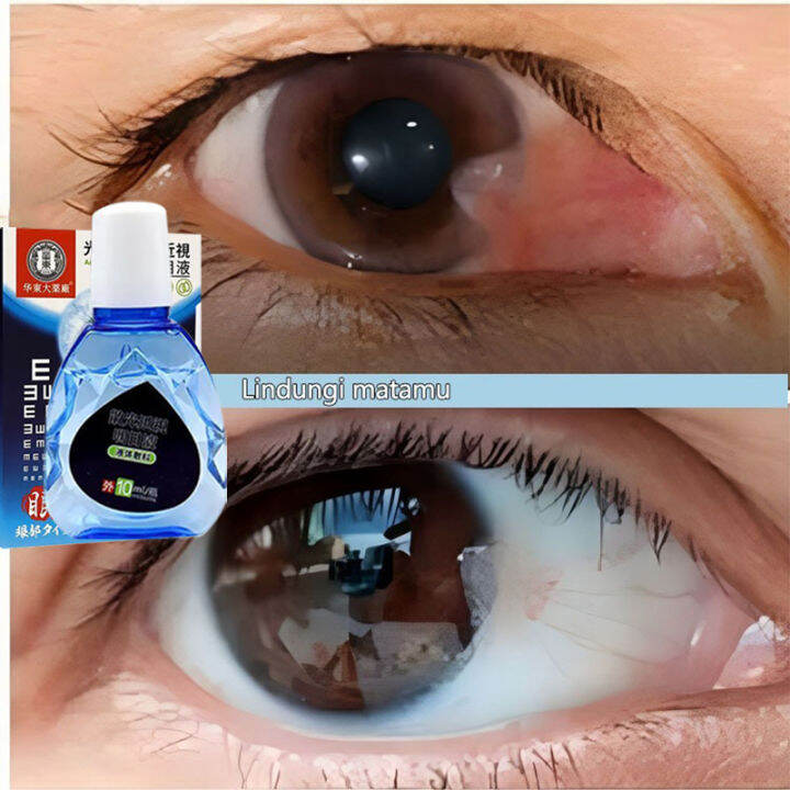 eye-drops-for-clear-vision-dry-eyes-congestion-eyes-blurry-eyes-red-eye