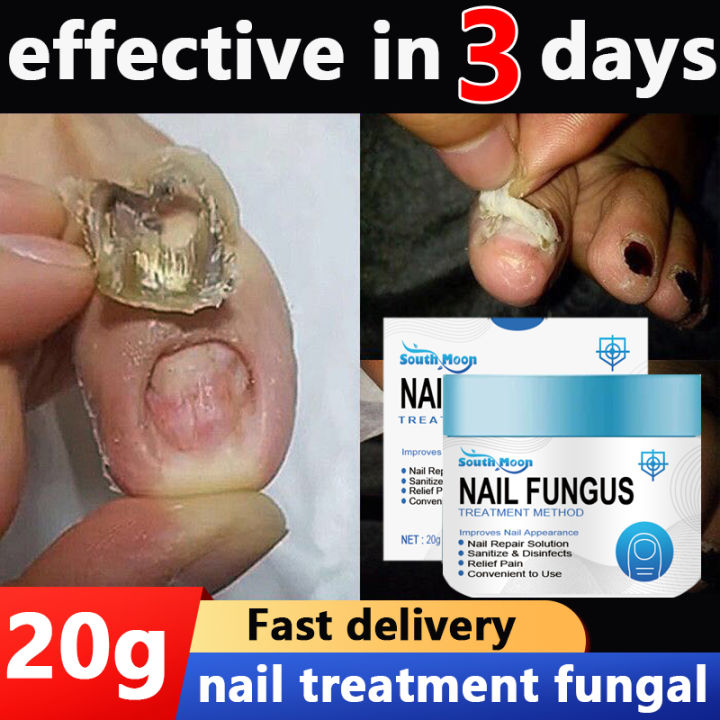 Emtrix sale fungal nail