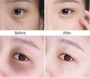 [ HOÀN TIỀN 15% ]  ERUM THẢO DƯỢC MỜ THÂM MẮT - MÔI HỒNG NHŨ HOA chống lão hóa hiệu quả sỉ sll
