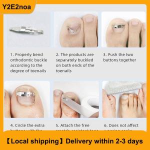 【Local shipping】 Ingrown Toenail Tools Pedicure Recover Embed Toe Nail Treatment Professional Foot Care Correction Tool Care Foot