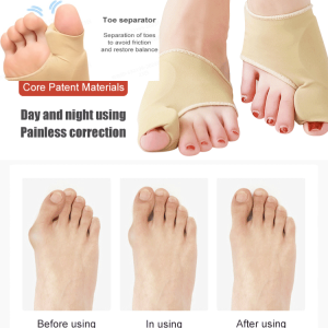 jiketai 1Pair Toe Separatorr Hallux Valgus Bunion Corrector Thumb valgus corrector Thumb Adjuster Sock