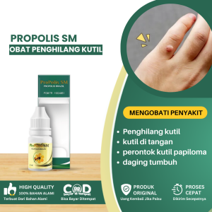 Obat Penghilang Kutil Anak Dan Dewasa Obat Kutil Di Wajah Obat Kutil Di Tangan Obat Perontok Kutil Papiloma Obat Pengelupas Kulit Menahun Obat Penghilang Bekas Kutil Obat Daging Tumbuh - Propolis SM