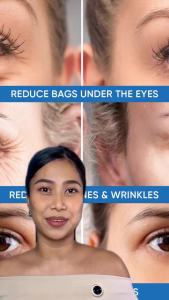 Under Eye Puffiness & Dark Circles Rapid ment- Instantly Reduces the Appearance of Puffy Eye Bags Crow’s Feet & Sagging Skin.