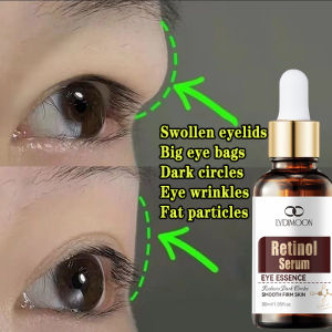 Swollen eyelids serum Big eye bags Retinol Eye Cream for man Dark circles Eye wrinkles Eliminate puffy eyelids Anti-aging Moisturize Brighten