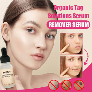 Eelhoe Remover Serum Mole Corrector Skin Tag Remover Black Spot Purifying Serum Skin Lightening Mole TAG Removal Skin Lightening Essences（20ml）