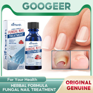 Ximonth Fungal Nail Treatment Removal Oil Foot Fungus Repair Essence Toe Fungus Removal Gel Anti Infection Best Essenice Nail Fungus Treatment Extra Strength Care Toenail Fungus Treatment Feet Care Essence Ringworm Repair(20ml)