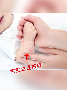 Upgraded Mosquito Net for Stroller Protective Baby Stroller Mosquito Net Perfect Bug Net for Strollers Bassinets Cradle-