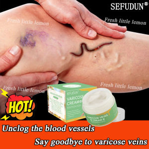 really effective~SEFUDUN Veins Creamin Leg Varicose Veins Remover Effective Original Spider Vein Pain Varicosity ​Leg Treatment Vasculitis Phlebitis Angiitis Ointment Health Removing Cream Varicose Varicose Ointment Varicose Remover Cream
