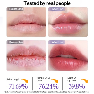 Lip Serum Anti-wrinkle Lip Moisturizer Serum Hydrating Plump Lightweight and Non-greasy 12h Moisturizing