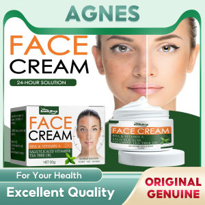 South Moon Effective Acne Removal Face Cream Herbal Anti Acne Gel Shrink Pores Oil Control Whitening Moisturizer Acne Scar Repair Skin Care Whitening Herbal Tea Tree Oil Acne Spot Treatment Removing Anti Acne Face Cream(30g)