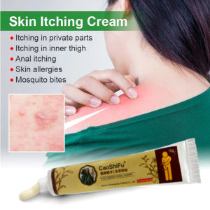 Psoriasis Cream Skin Care Cream Dermatitis Eczematoid Eczema Ointment Treatment 20g