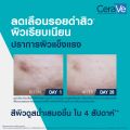 Cerave Resurfacing Retinol Serum 30Ml เซรั่มบำรุงผิวหน้า สำหรับผู้มีปัญหารอยดำจากสิว. 