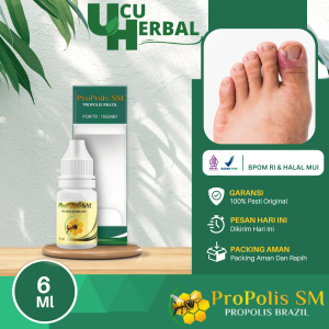 Obat Cantengan Kuku Jempol Kaki Tangan yang Bernanah Nyeri dan Bau Busuk Herbal Propolis SM