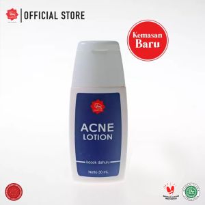 Viva Acne Lotion: Solusi Terbaik Untuk Pria Berjerawat