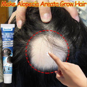Alopecia hair growth cream 20g Hair fall treatment Hair loss cream Alopecia areata Baldness treat Rapidly repair hair follicles and regenerate hair