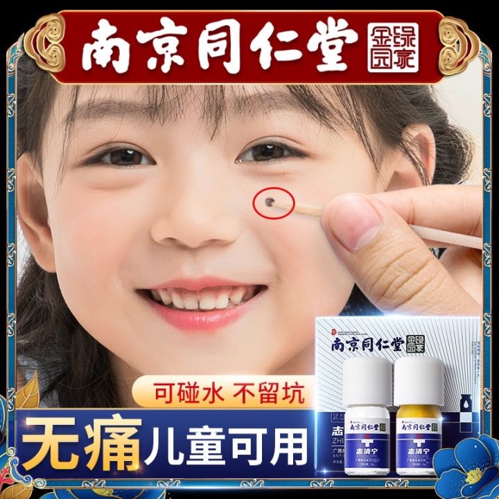 南京同仁堂志清宁点痣水膏祛痣 BUANG LALAT Removing Against Moles Remove Nevus mole ...